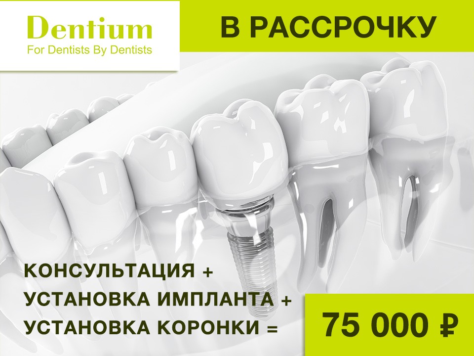 Dentium в рассрочку